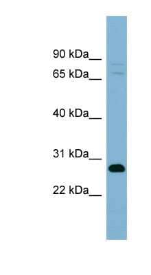 Western Blot: TMEM176A Antibody [NBP1-60015]