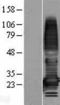 Western Blot: TMEM176A Overexpression Lysate [NBL1-17041]