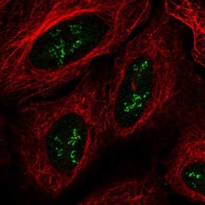 Immunocytochemistry/ Immunofluorescence: TMEM177 Antibody [NBP2-55482]