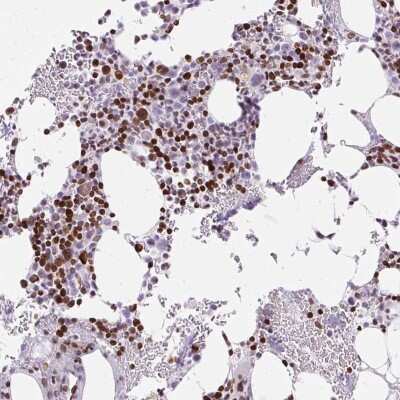 Immunohistochemistry-Paraffin: TMEM177 Antibody [NBP2-31567]