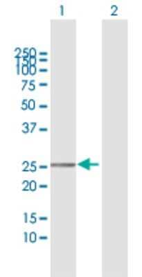 Western Blot: TMEM177 Antibody [H00080775-D01P]