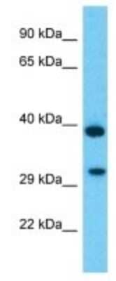 Western Blot: TMEM177 Antibody [NBP3-09896]