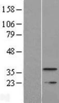 Western Blot: TMEM177 Overexpression Lysate [NBL1-17043]