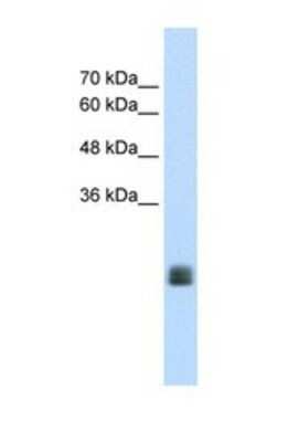 Western Blot: TMEM178 Antibody [NBP1-69634]