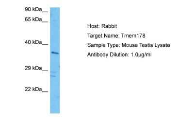 Western Blot: TMEM178 Antibody [NBP2-85940]