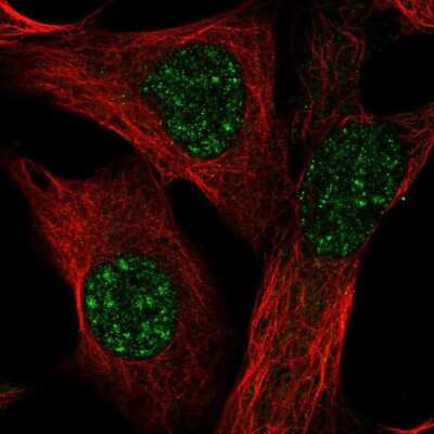 Immunocytochemistry/ Immunofluorescence: TMEM179B Antibody [NBP2-57161]