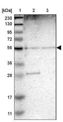 Western Blot: TMEM180 Antibody [NBP1-90827]