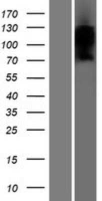 Western Blot: TMEM180 Overexpression Lysate [NBP2-06282]