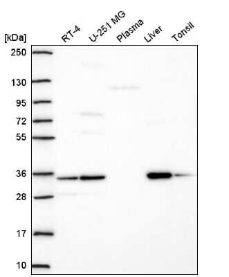 Western Blot: TMEM183A Antibody [NBP2-57517]