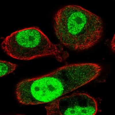 Immunocytochemistry/ Immunofluorescence: TMEM184A Antibody [NBP2-56814]