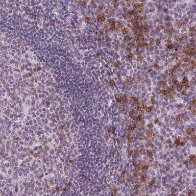 Immunohistochemistry: TMEM184A Antibody [NBP2-49656]