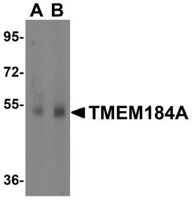 Western Blot: TMEM184A AntibodyBSA Free [NBP1-77142]