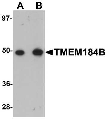 Western Blot: TMEM184B AntibodyBSA Free [NBP1-77143]