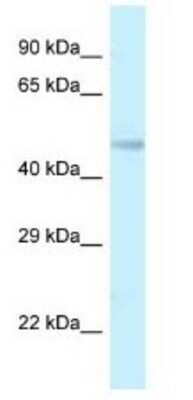 Western Blot: TMEM184B Antibody [NBP1-79196]