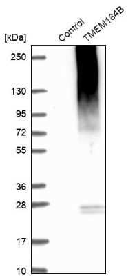 Western Blot: TMEM184B Antibody [NBP1-86810]