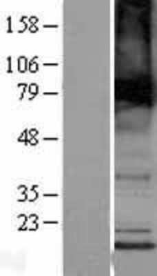 Western Blot: TMEM184B Overexpression Lysate [NBP2-04333]