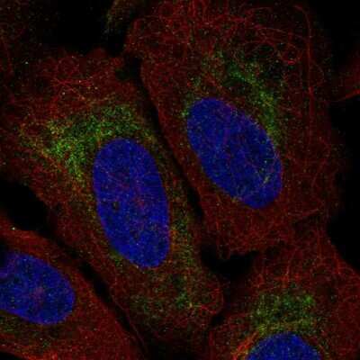 Immunocytochemistry/ Immunofluorescence: TMEM185A Antibody [NBP2-57773]