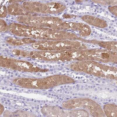 Immunohistochemistry-Paraffin: TMEM185A Antibody [NBP2-13448]