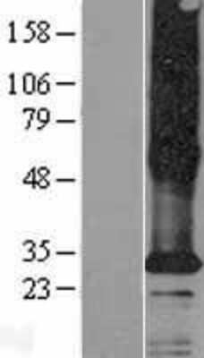 Western Blot: TMEM185A Overexpression Lysate [NBP2-06013]