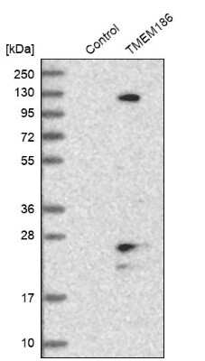 Western Blot: TMEM186 Antibody [NBP1-88452]