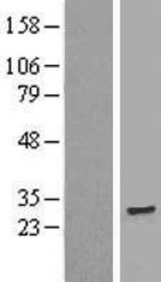 Western Blot: TMEM186 Overexpression Lysate [NBL1-17049]