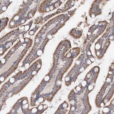 Immunohistochemistry-Paraffin: TMEM187 Antibody [NBP1-85373]