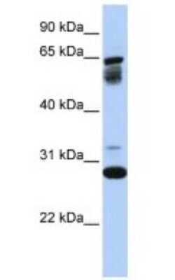 Western Blot: TMEM187 Antibody [NBP1-69553]