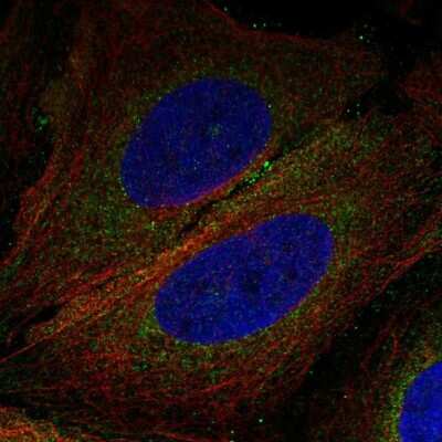 Immunocytochemistry/ Immunofluorescence: TMEM188 Antibody [NBP2-58839]