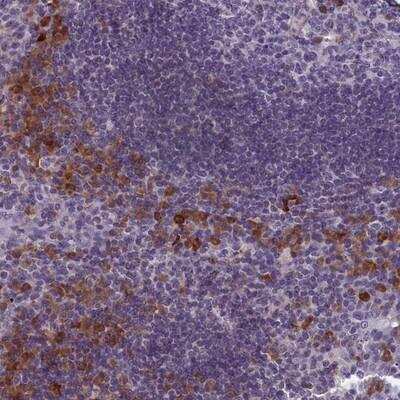 Immunohistochemistry-Paraffin: TMEM188 Antibody [NBP1-88455]