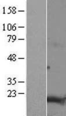 Western Blot: TMEM188 Overexpression Lysate [NBL1-17050]