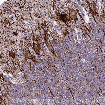 Immunohistochemistry-Paraffin: TMEM189 Antibody [NBP2-32476]
