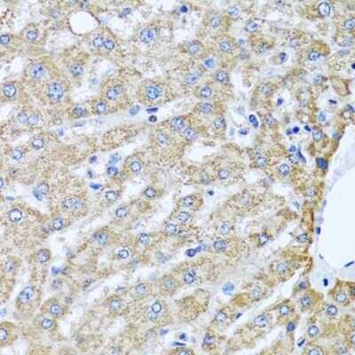 Immunohistochemistry-Paraffin: TMEM189 Antibody - BSA Free [NBP2-94610]