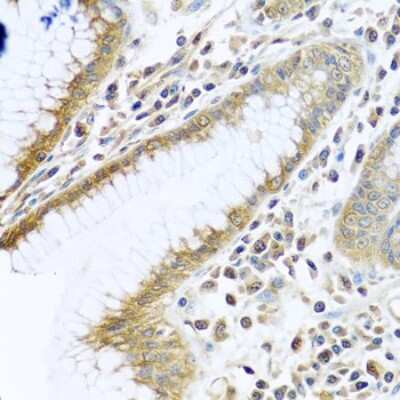 Immunohistochemistry-Paraffin: TMEM189 Antibody - BSA Free [NBP2-94610]