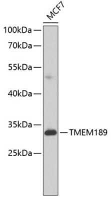 Western Blot: TMEM189 AntibodyBSA Free [NBP2-94610]