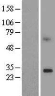 Western Blot: TMEM189 Overexpression Lysate [NBL1-17051]