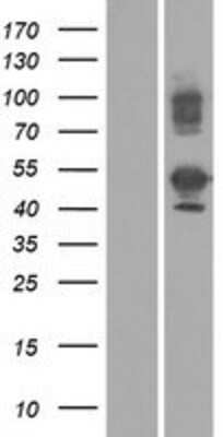 Western Blot: Kua-UEV Overexpression Lysate [NBP2-04652]