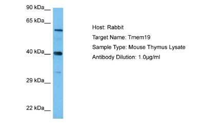 Western Blot: TMEM19 Antibody [NBP2-83682]