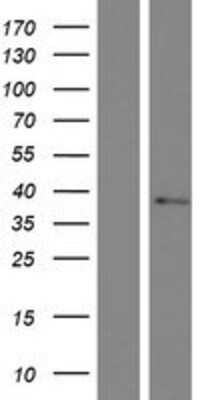 Western Blot: TMEM19 Overexpression Lysate [NBP2-06829]