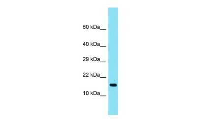 Western Blot: TMEM190 Antibody [NBP3-09652]