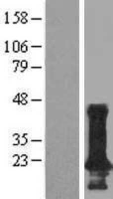 Western Blot: TMEM190 Overexpression Lysate [NBP2-05593]