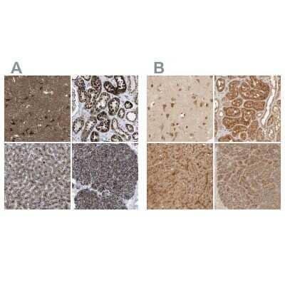 Immunohistochemistry-Paraffin: TMEM192 Antibody [NBP1-93798]