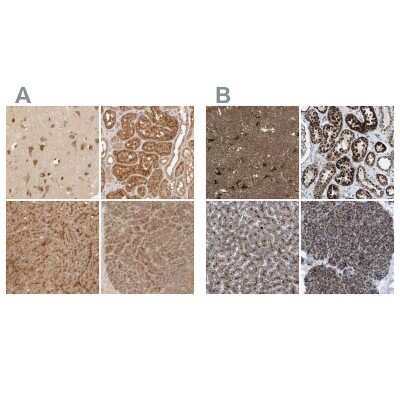 Immunohistochemistry-Paraffin: TMEM192 Antibody [NBP1-93799]