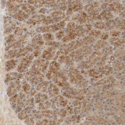 Immunohistochemistry-Paraffin: TMEM192 Antibody [NBP1-93799]