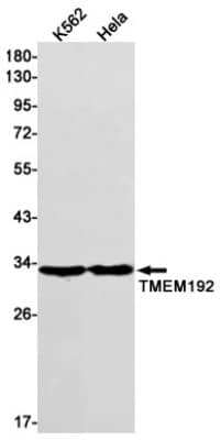 Western Blot: TMEM192 Antibody (S02-3F9) [NBP3-19787]