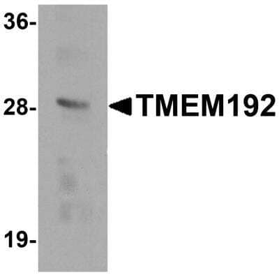 Western Blot: TMEM192 AntibodyBSA Free [NBP2-82029]