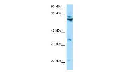 Western Blot: TMEM192 Antibody [NBP2-85943]