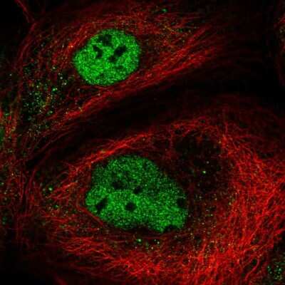 Immunocytochemistry/ Immunofluorescence: TMEM194B Antibody [NBP2-55525]