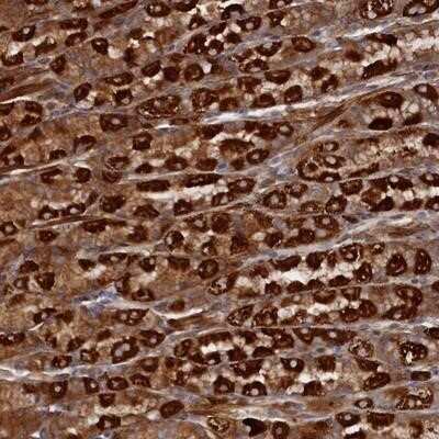 Immunohistochemistry-Paraffin: TMEM196 Antibody [NBP1-93472]