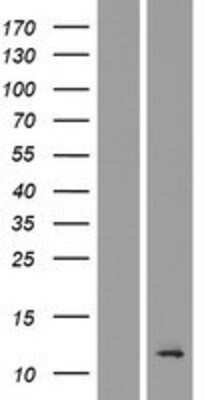 Western Blot: TMEM196 Overexpression Lysate [NBP2-04428]