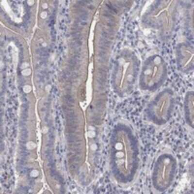 Immunohistochemistry-Paraffin: TMEM198 Antibody [NBP3-17550]